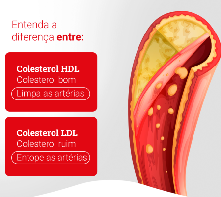 Você sabe a Diferença entre HDL e LDL