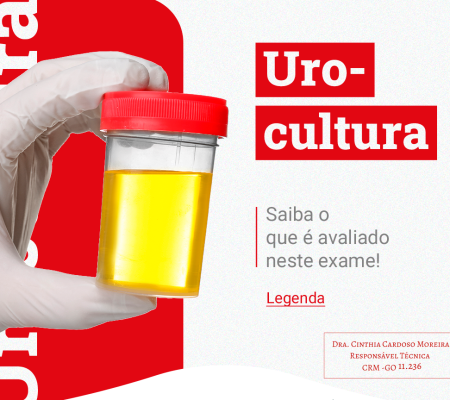 UROCULTURA